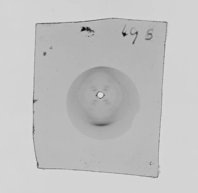 Photograph 49: The X-ray Watson did not see