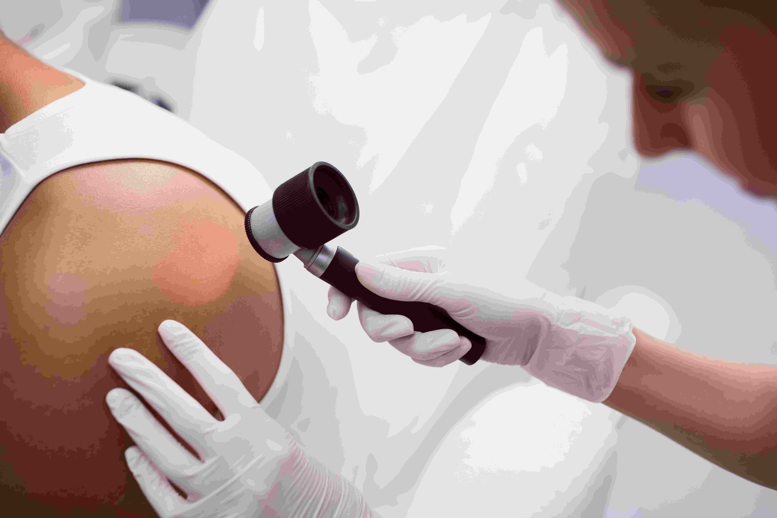 The Benefits of Choosing a Skin Cancer Clinic in Newcastle