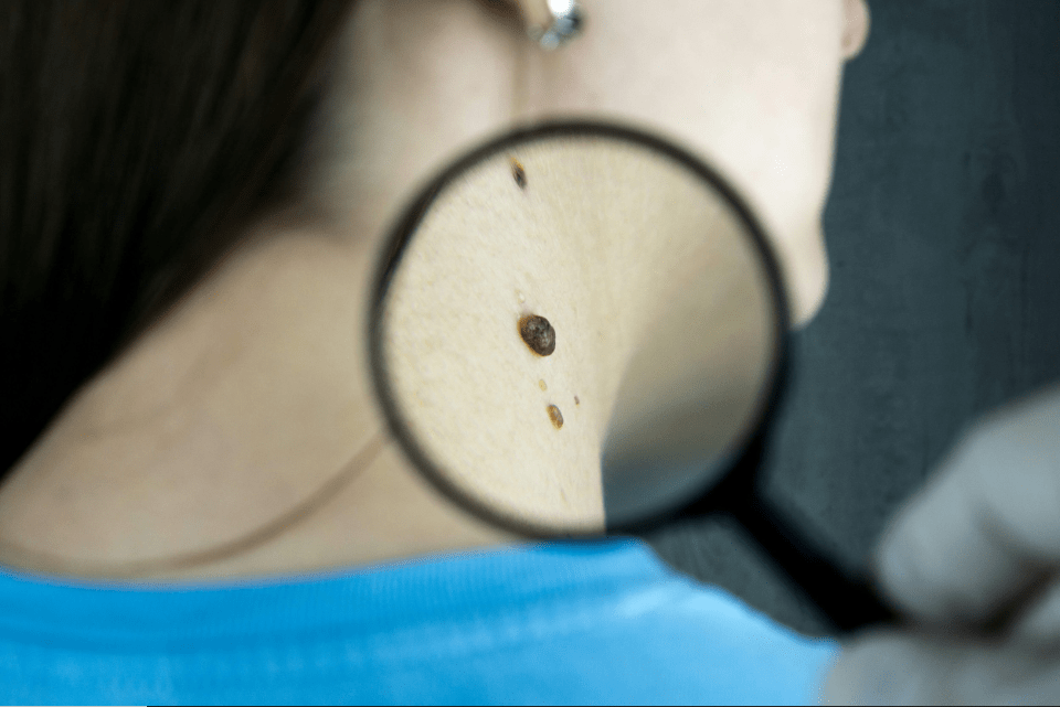 Newcastle Skin Medical Centre: Expert Care for Skin Cancers, Rashes, and Complex Skin Disorders