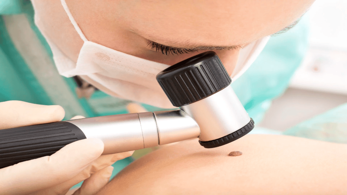 The Benefits of Skin Checks in Newcastle: Why Regular Screenings Matter