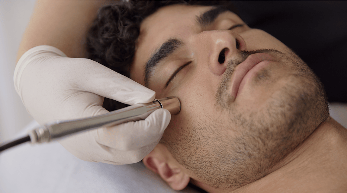 Achieve Beautiful, Healthy Skin with Expert Skin Treatments in Newcastle