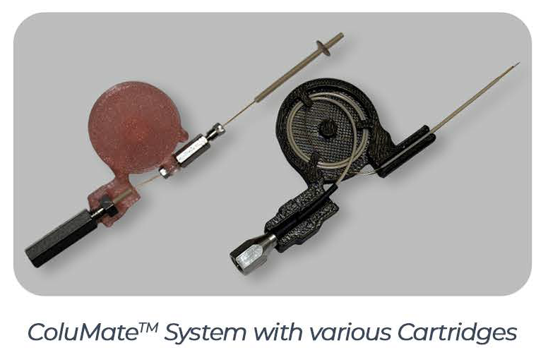 ColuMate -Ready columns