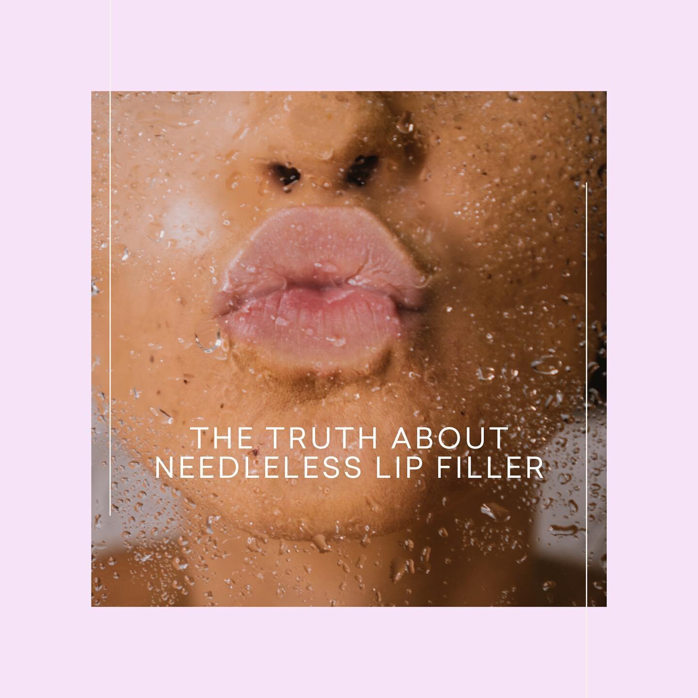 Lip fillers without needles? Yes, please 💋 

The Hyaluron Pen and other needle-free filler devices are here to make lip filler less painful, more affordable, and exquisitely precise.

//

#hyaluronpen #lipfiller #lipfillerbeforeandafter #fulllips #n