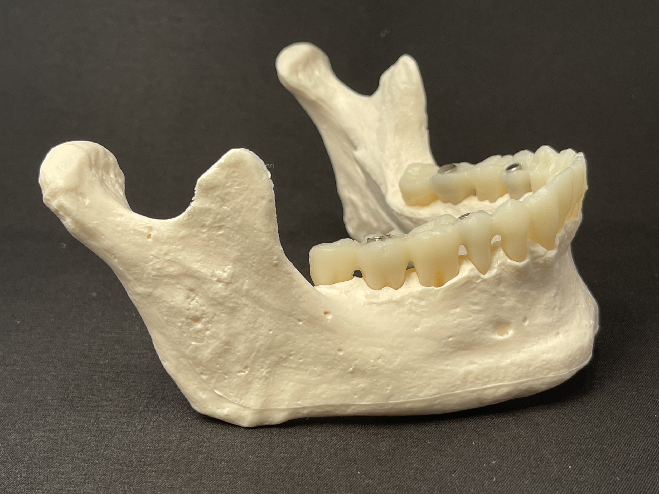 TMJ Energetics Part 1: The Mandible