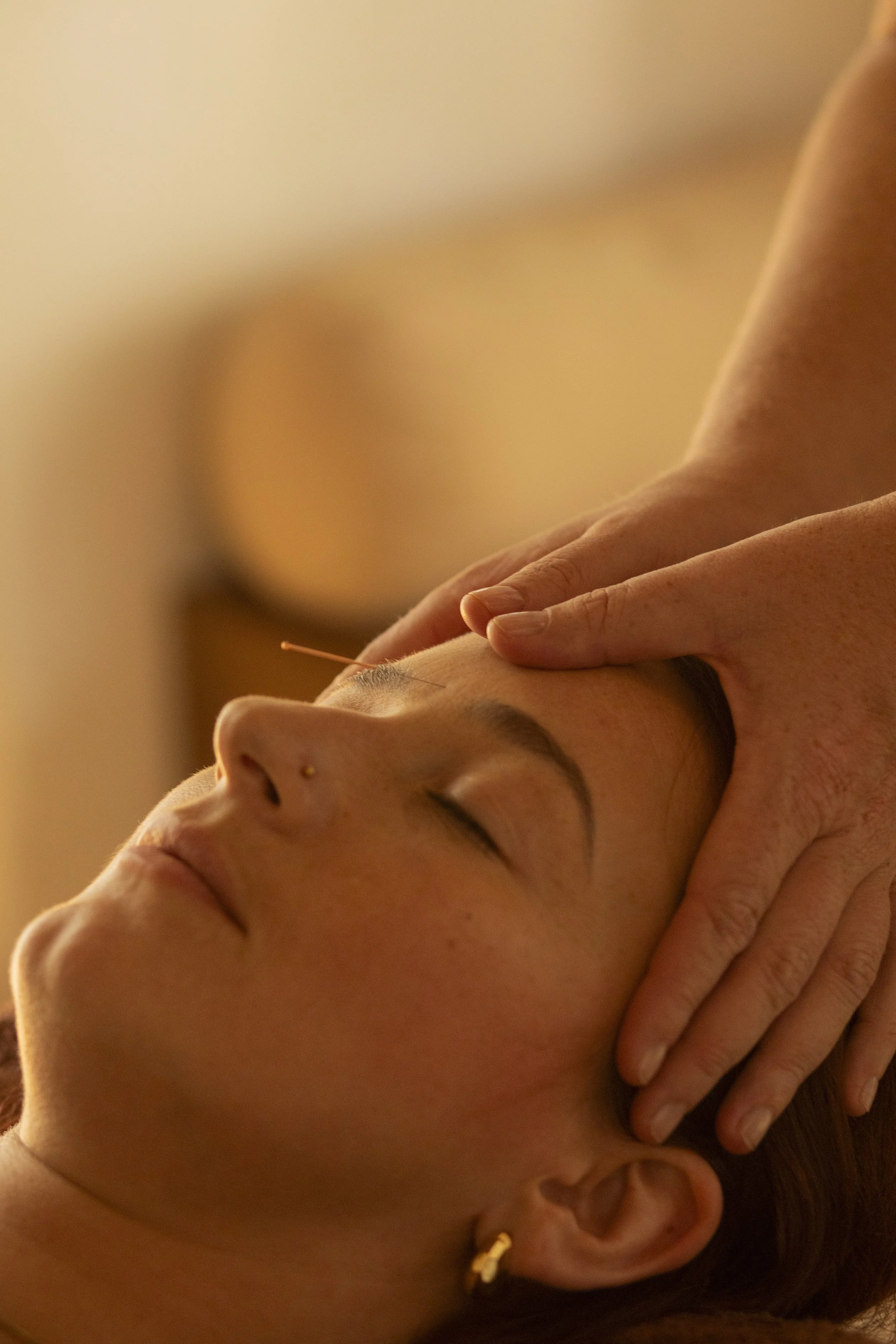 Acupuncture wellness retreat.jpeg