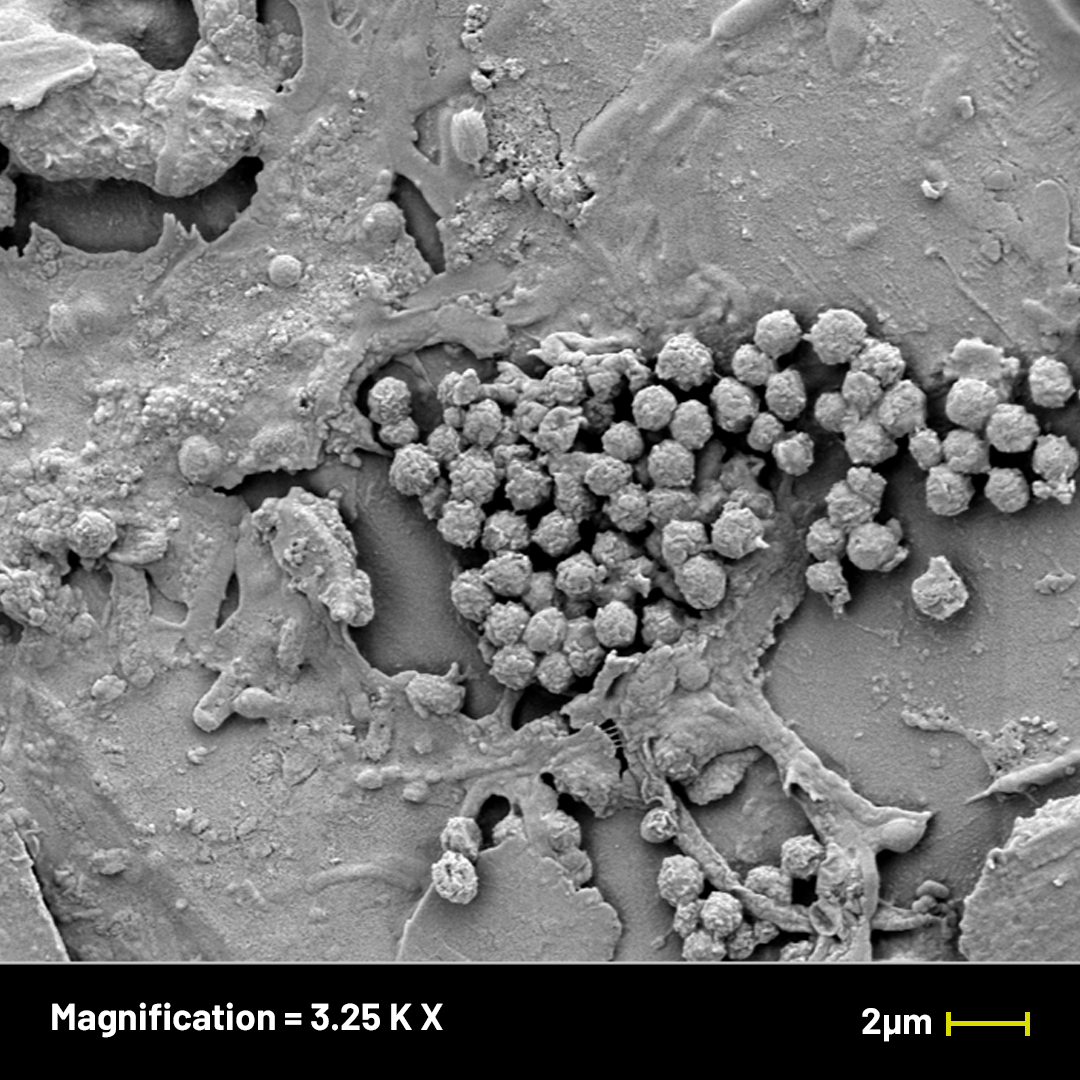 Solinatra Under the Microscope — Solinatra