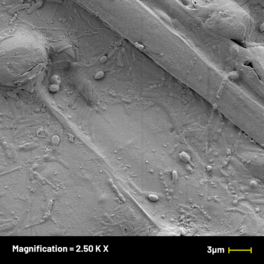Solinatra Under the Microscope — Solinatra