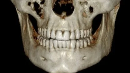 CBCT Scan at DMD Imaging