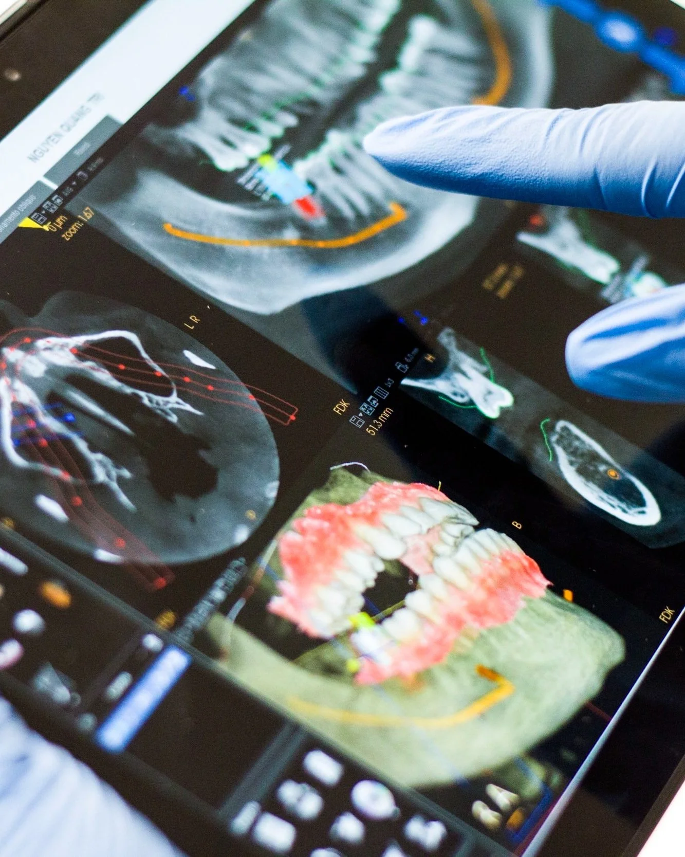 DMD Imaging technology and dental radiology reporting