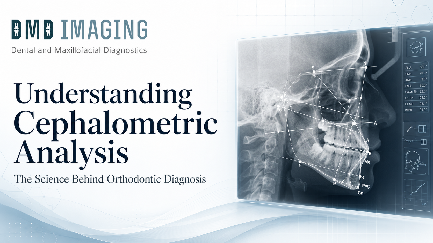 Understanding Cephalometric Analysis: The Science Behind Orthodontic Diagnosis