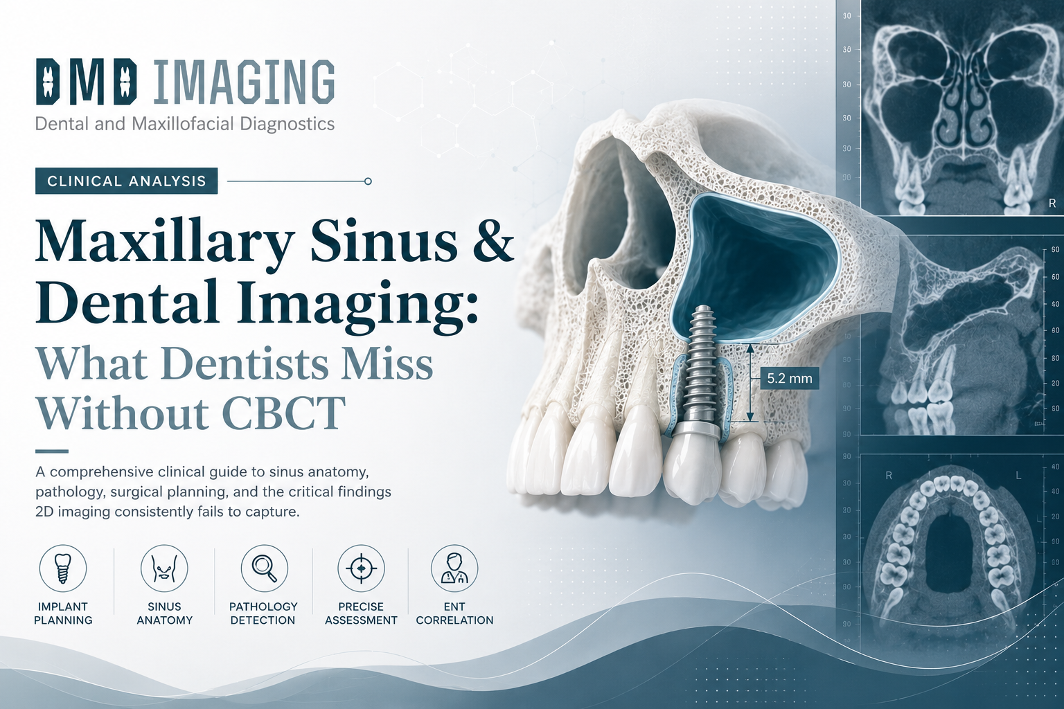 Maxillary Sinus and Dental Imaging: What Dentists Miss Without CBCT