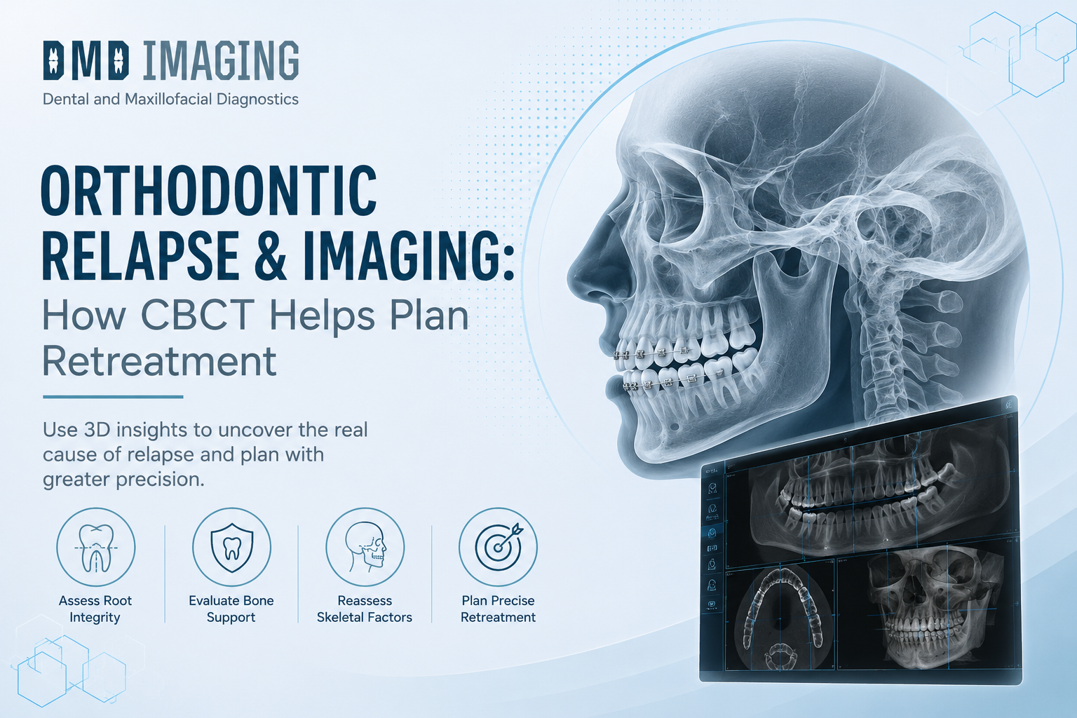 Orthodontic Relapse and Imaging: How CBCT Helps Plan Retreatment&nbsp;