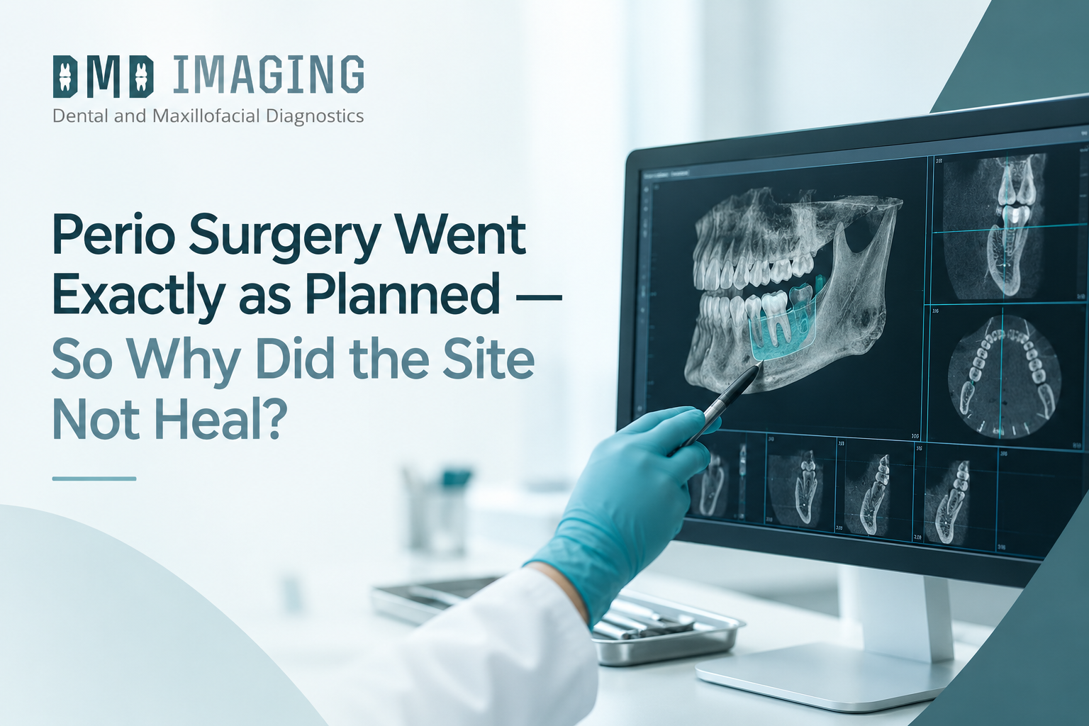 Perio Surgery Went Exactly as Planned — So Why Did the Site Not Heal?