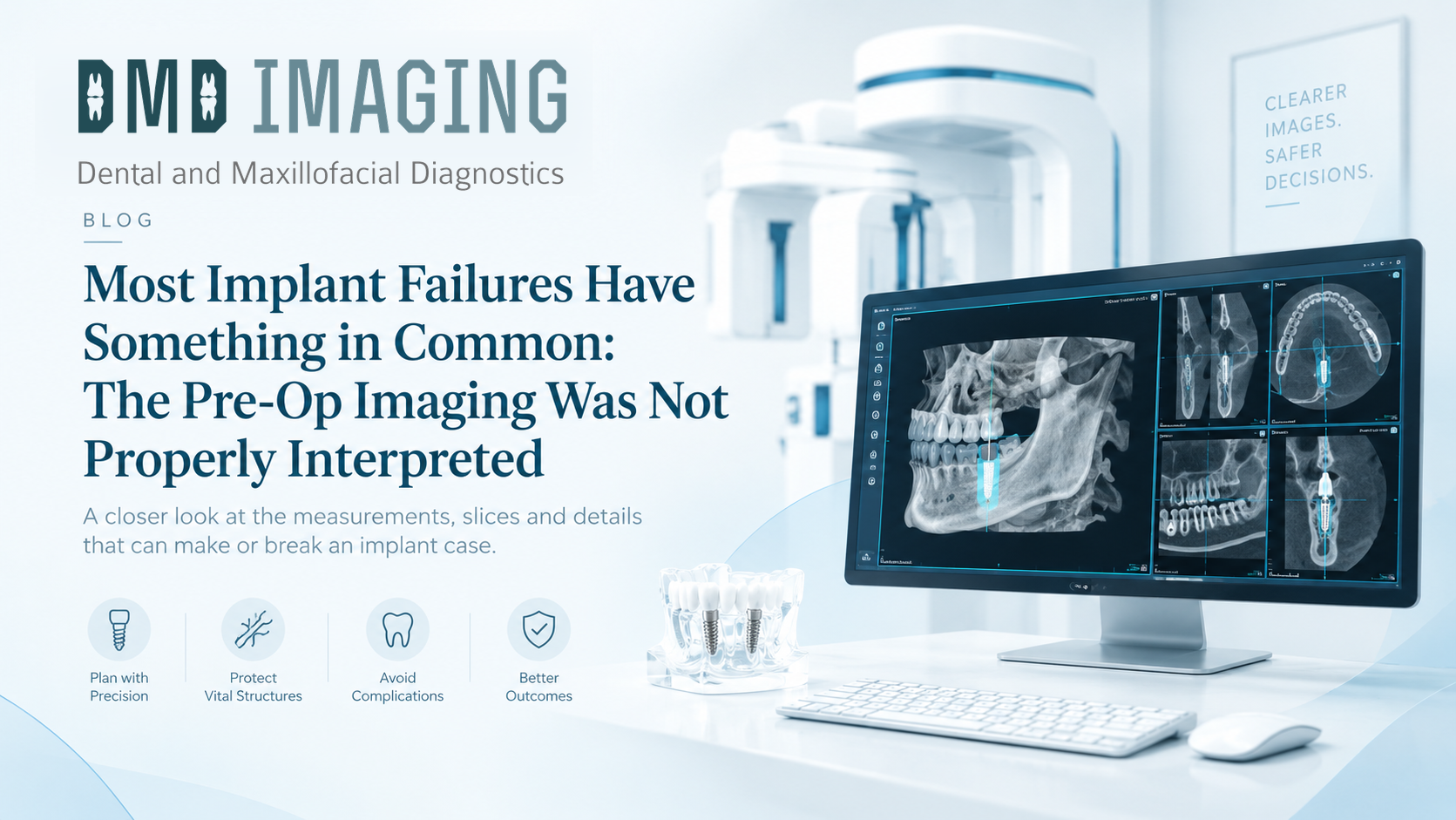 Most Implant Failures Have Something in Common: The Pre-Op Imaging Was Not Properly Interpreted