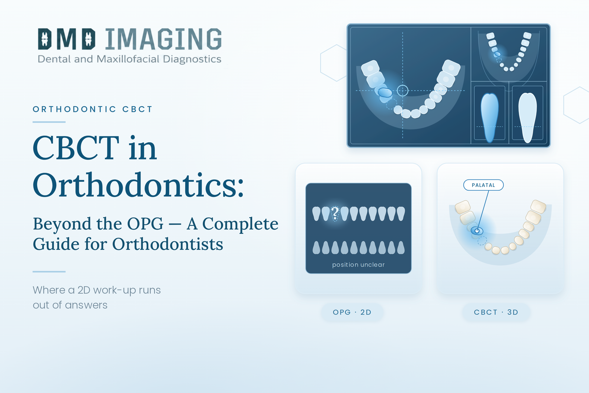 CBCT in Orthodontics: Beyond the OPG — A Complete Guide for Orthodontists