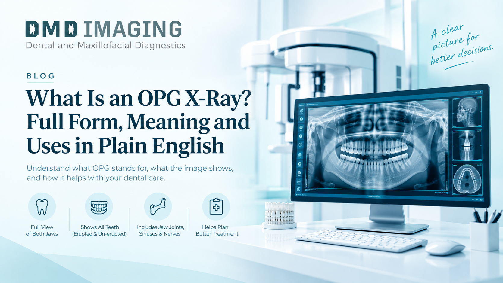 What Is an OPG X-Ray? Full Form, Meaning and Uses in Plain English