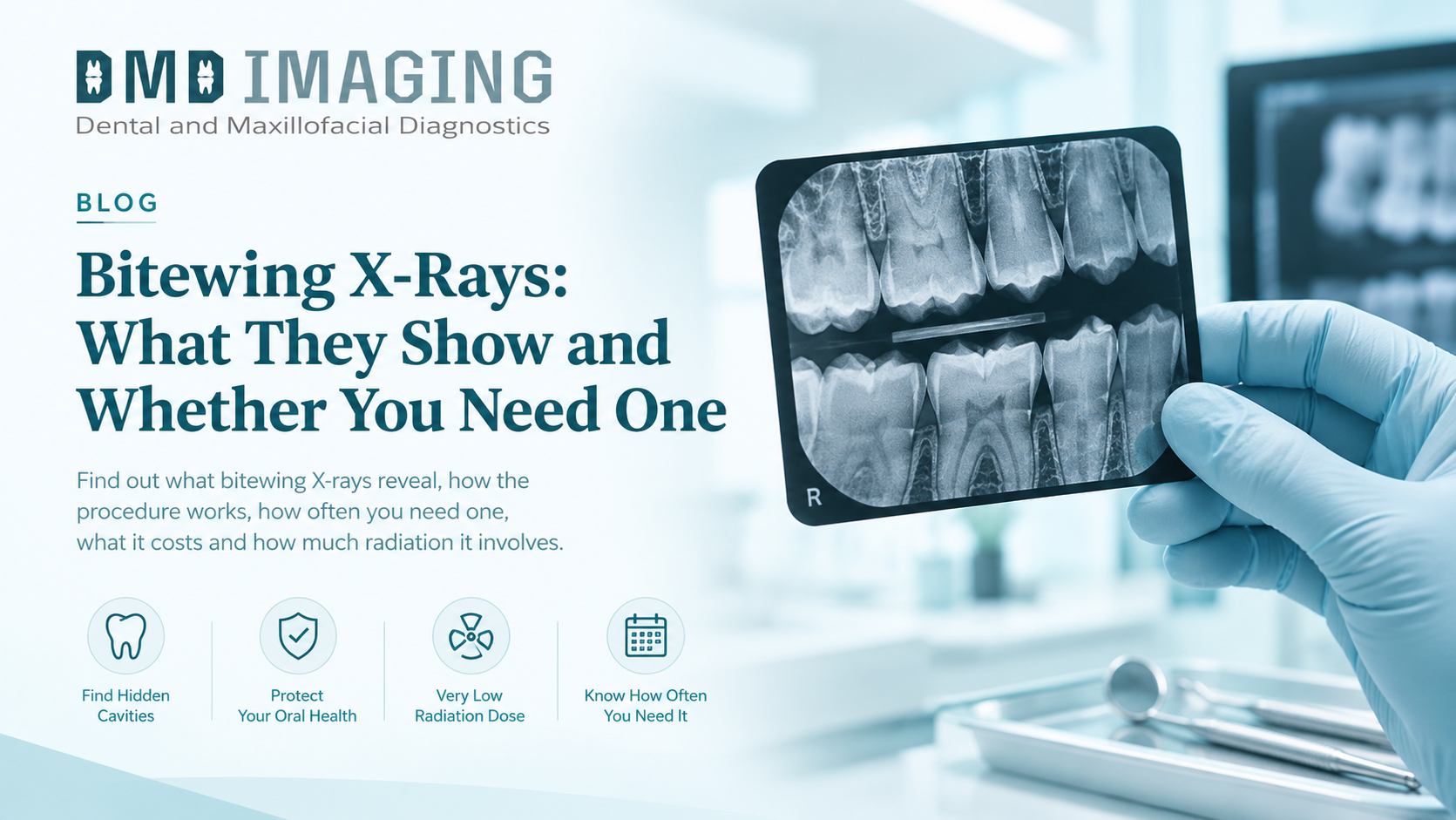 Bitewing X-Rays: What They Show and Whether You Need One