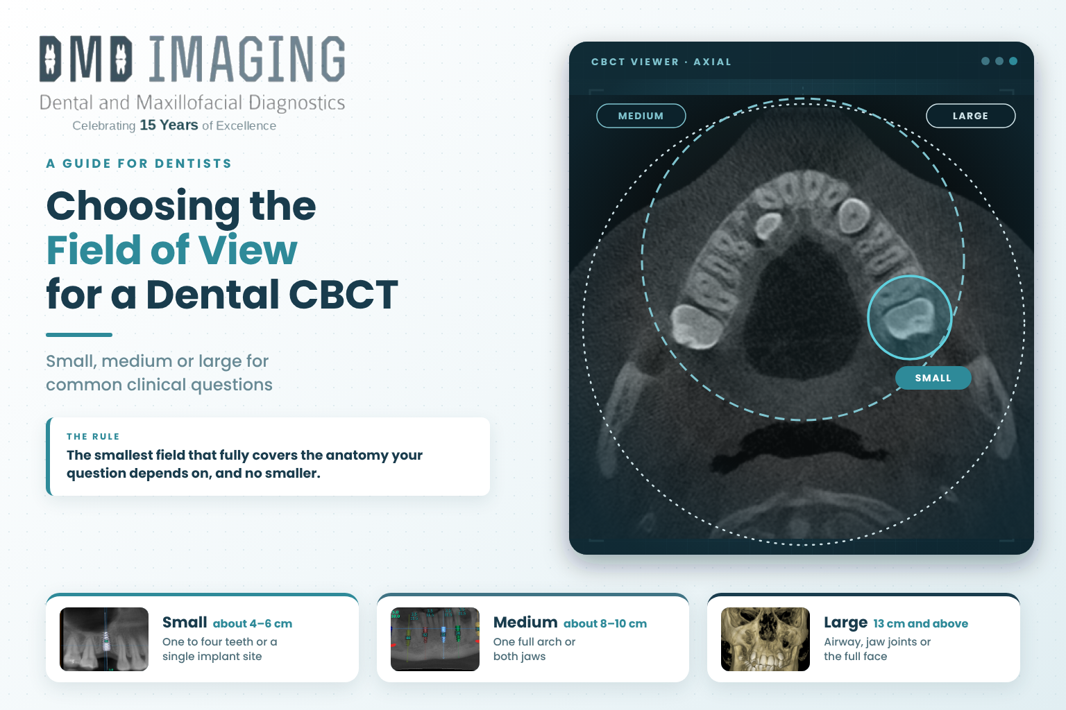 Choosing the Field of View for a Dental CBCT: Small, Medium or Large for Common Clinical Questions