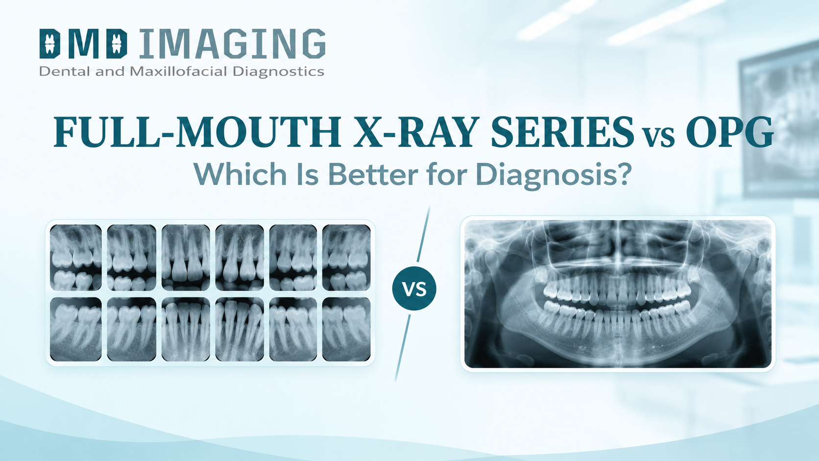 Full-Mouth X-Ray Series vs OPG: Which Is Better for Diagnosis?