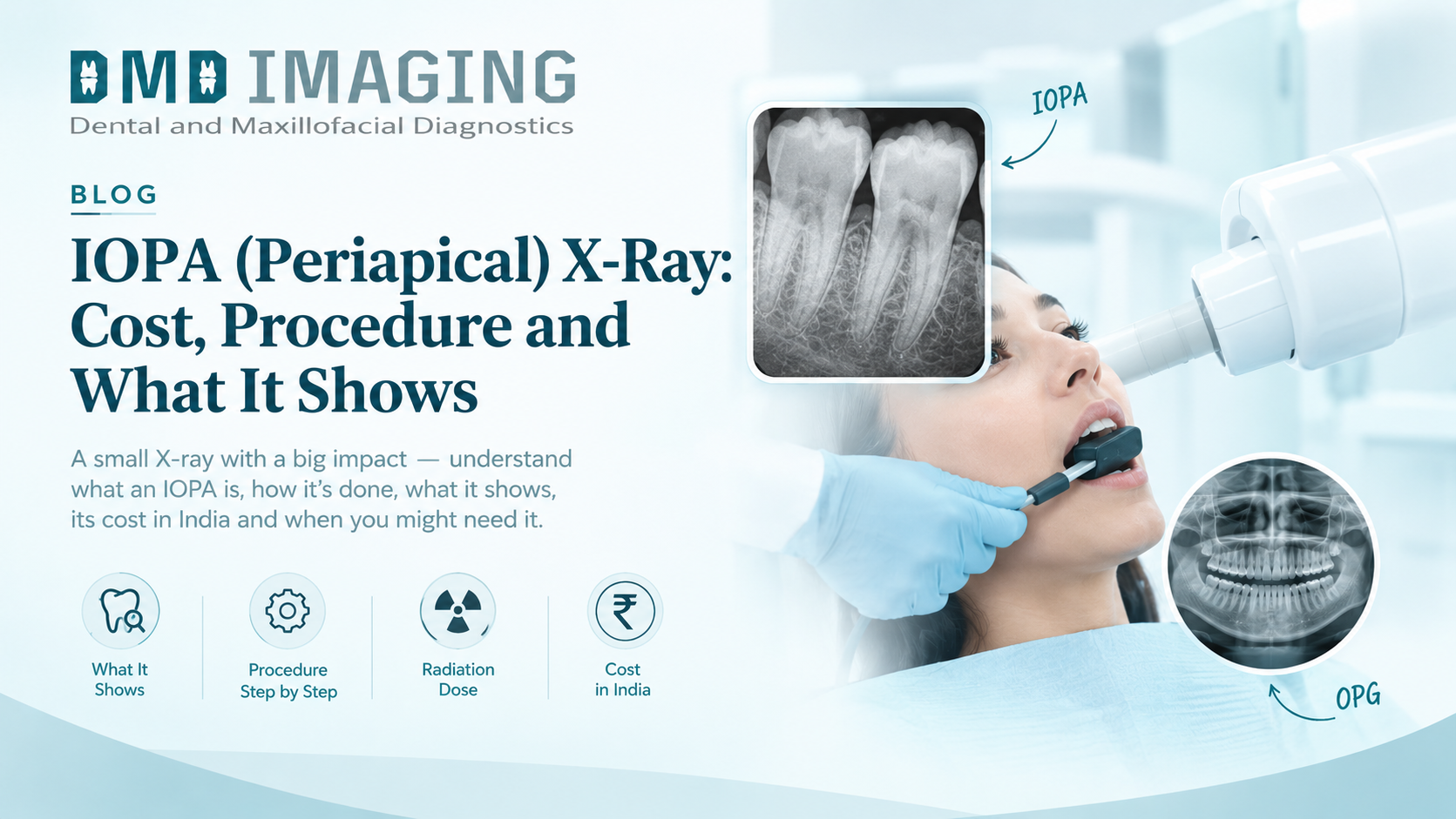 IOPA (Periapical) X-Ray: Cost, Procedure and What It Shows