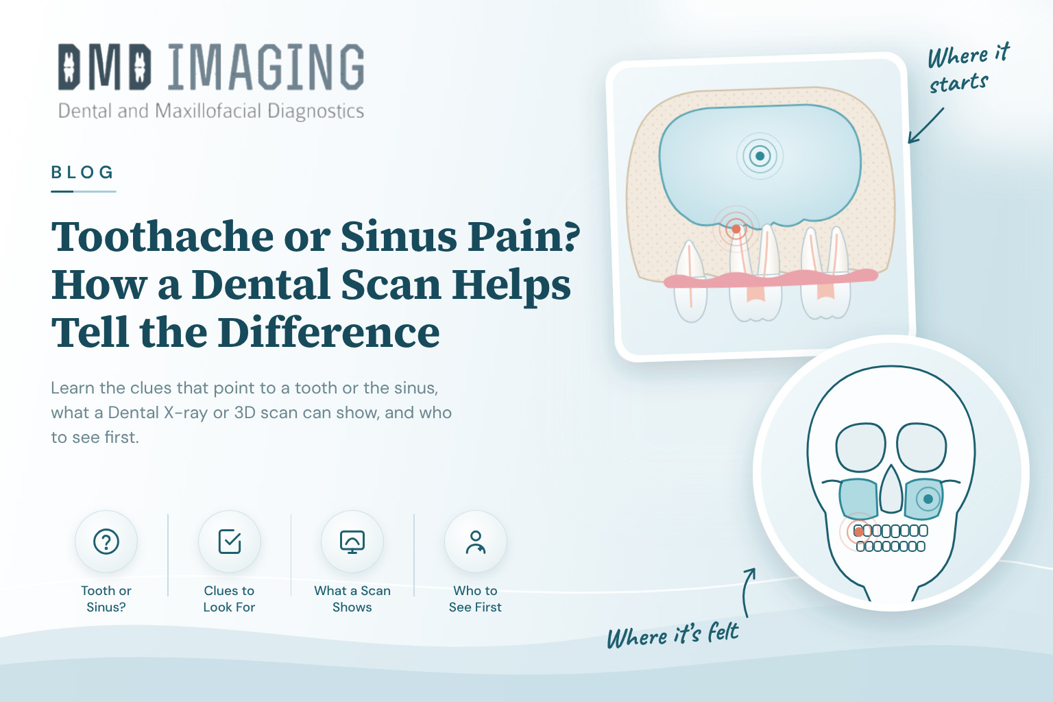 Toothache or Sinus Pain? How a Dental Scan Helps Tell the Difference
