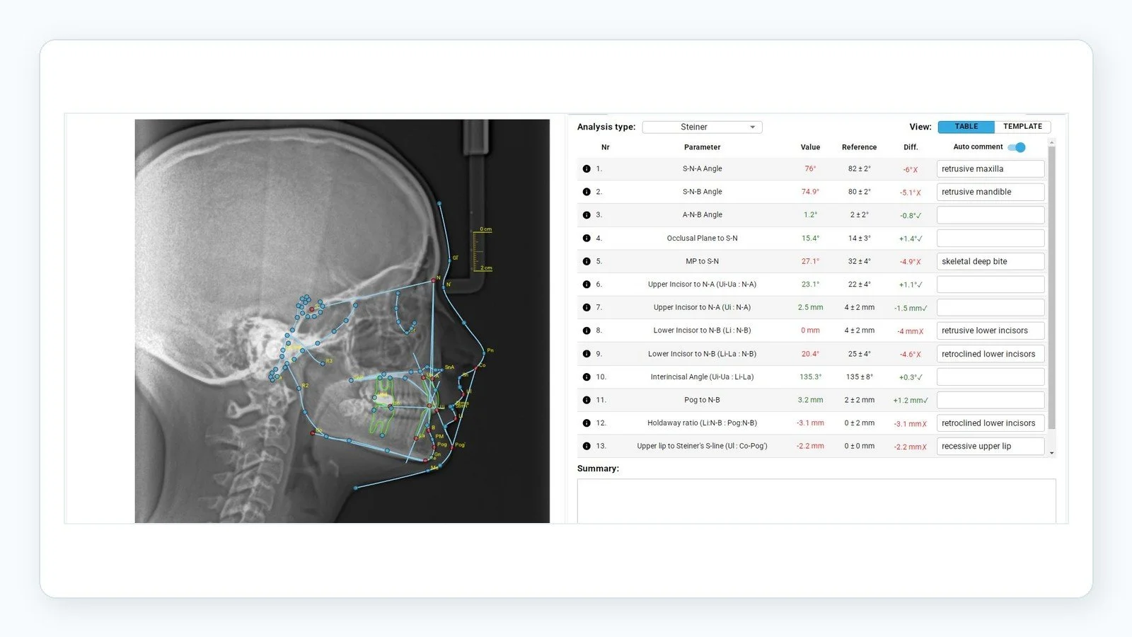 Lateral cephalometric radiograph with Steiner analysis table showing orthodontic measurements and diagnostic landmarks