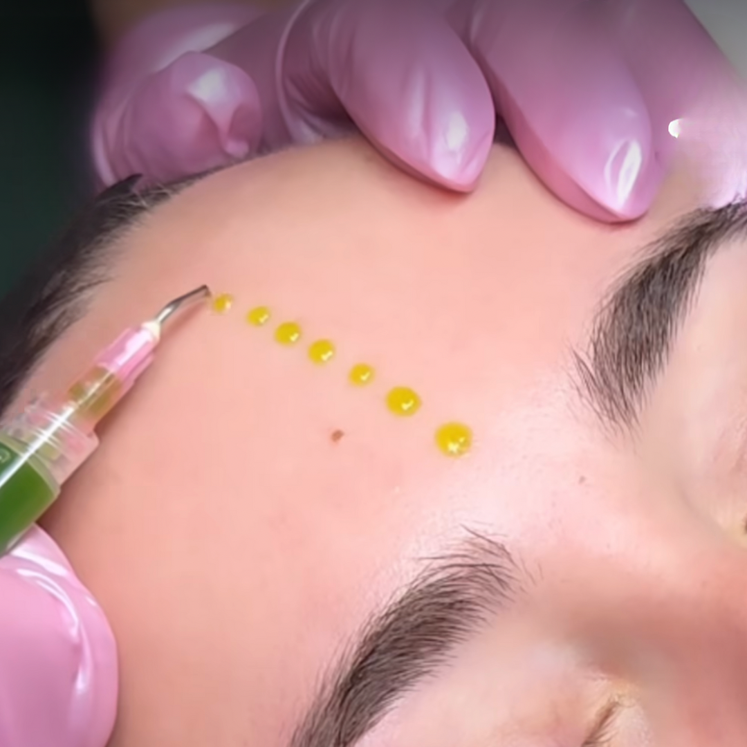 What is the BioRePeel