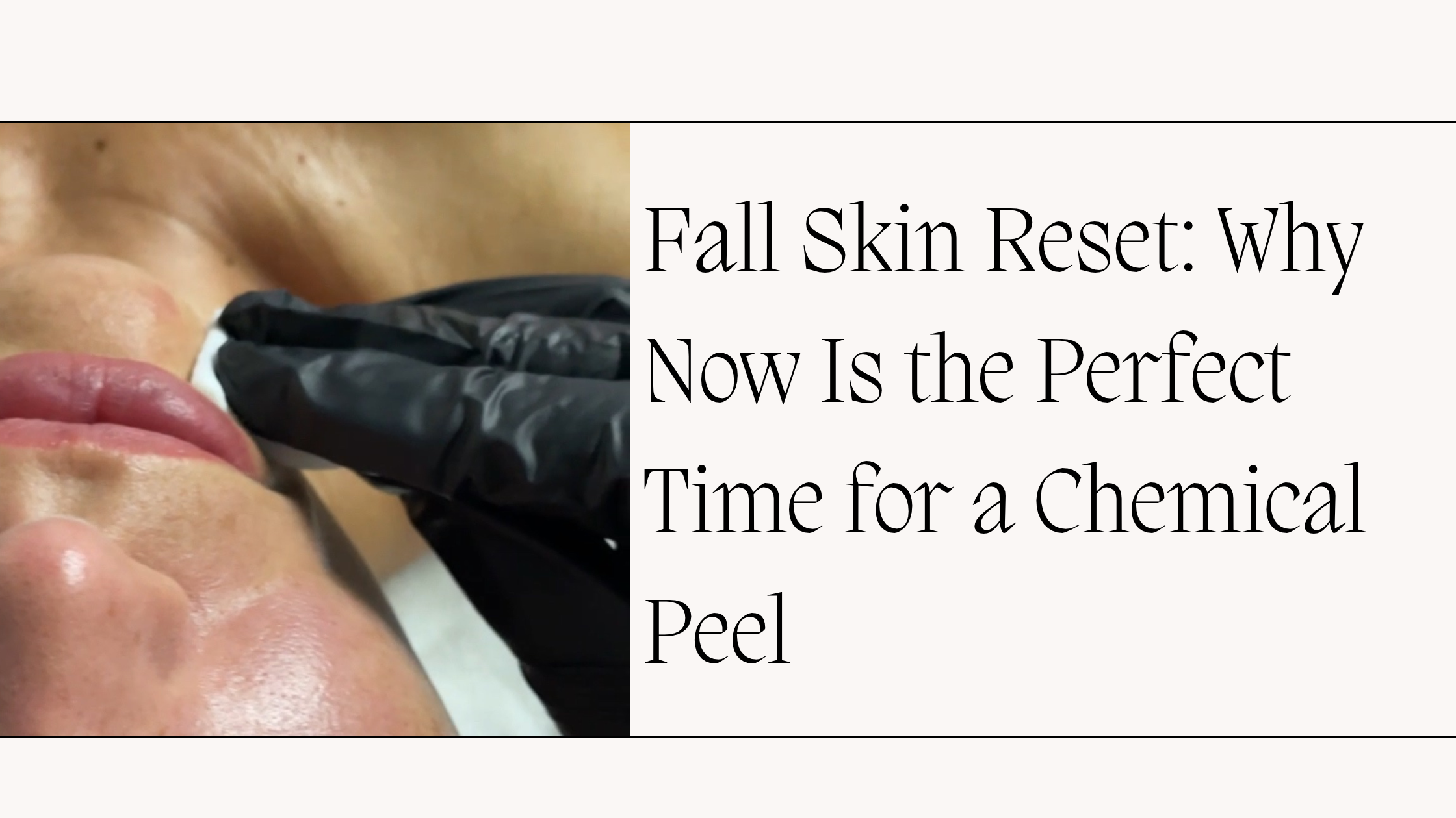 Fall Skin Reset: Why Now Is the Perfect Time for a Chemical Peel