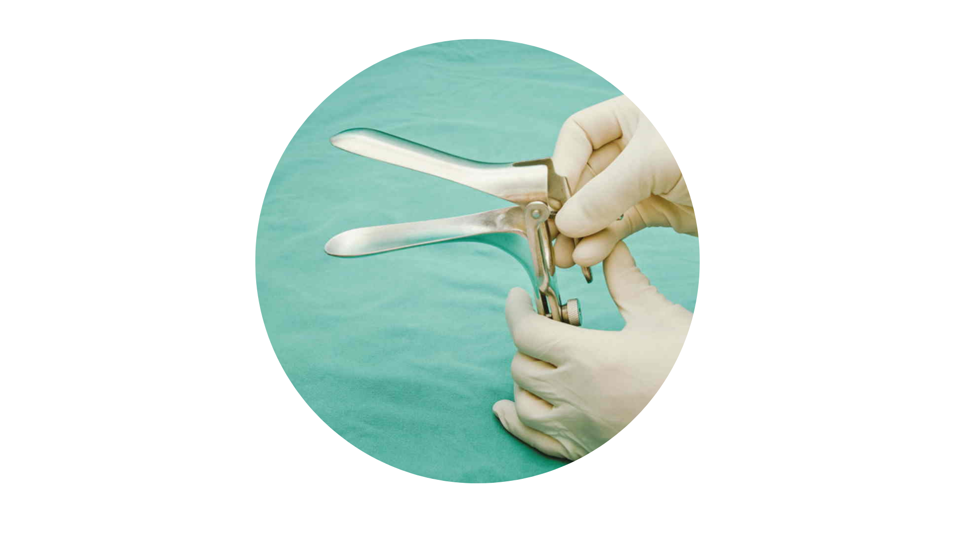 91. Leer el Mavrogeni-Papanicolaou