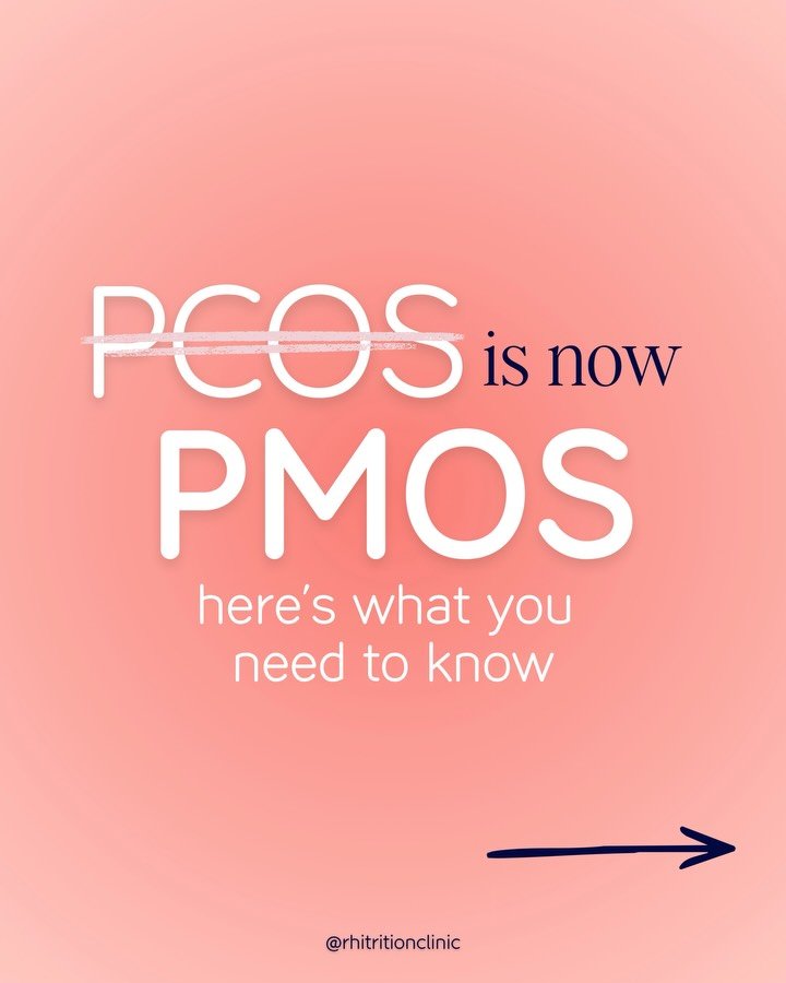 PCOS has officially been renamed PMOS - polyendocrine metabolic ovarian syndrome - in a move designed to better reflect the true complexity of the condition.

For years, experts have argued that the term &ldquo;polycystic ovary syndrome&rdquo; was mi