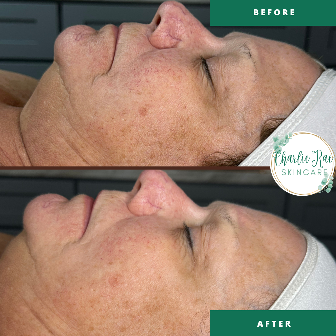 Copy of Before and after Procell .png