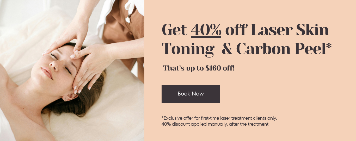 Laser skin toning or carbon peel 40% off fore new customers