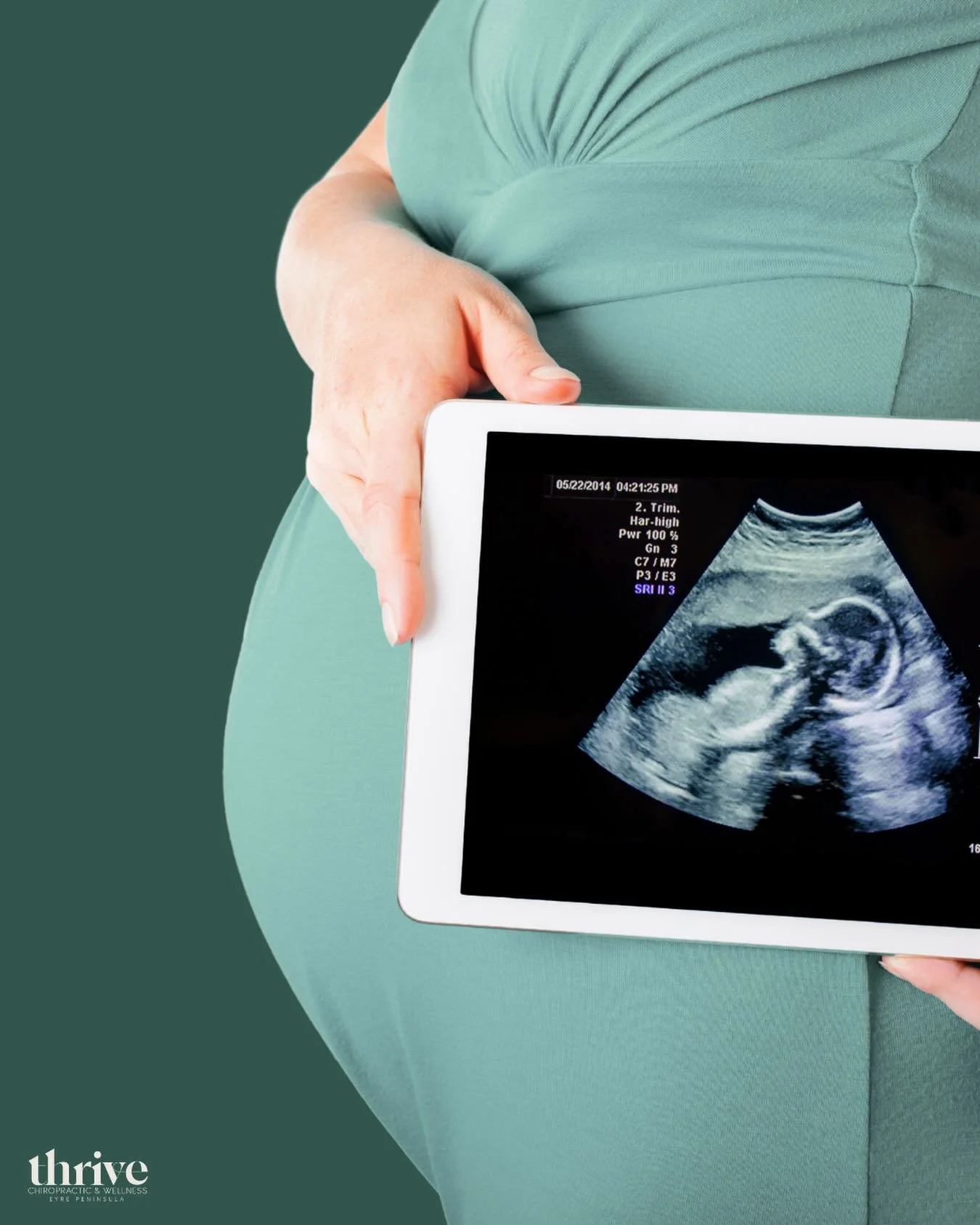 🤰 Pregnant and feeling it in your back or pelvis?
You&rsquo;re not alone.

Research shows up to 75% of pregnant mums experience back or pelvic pain at some point during pregnancy.

As your body changes, your spine, pelvis, and nervous system are con