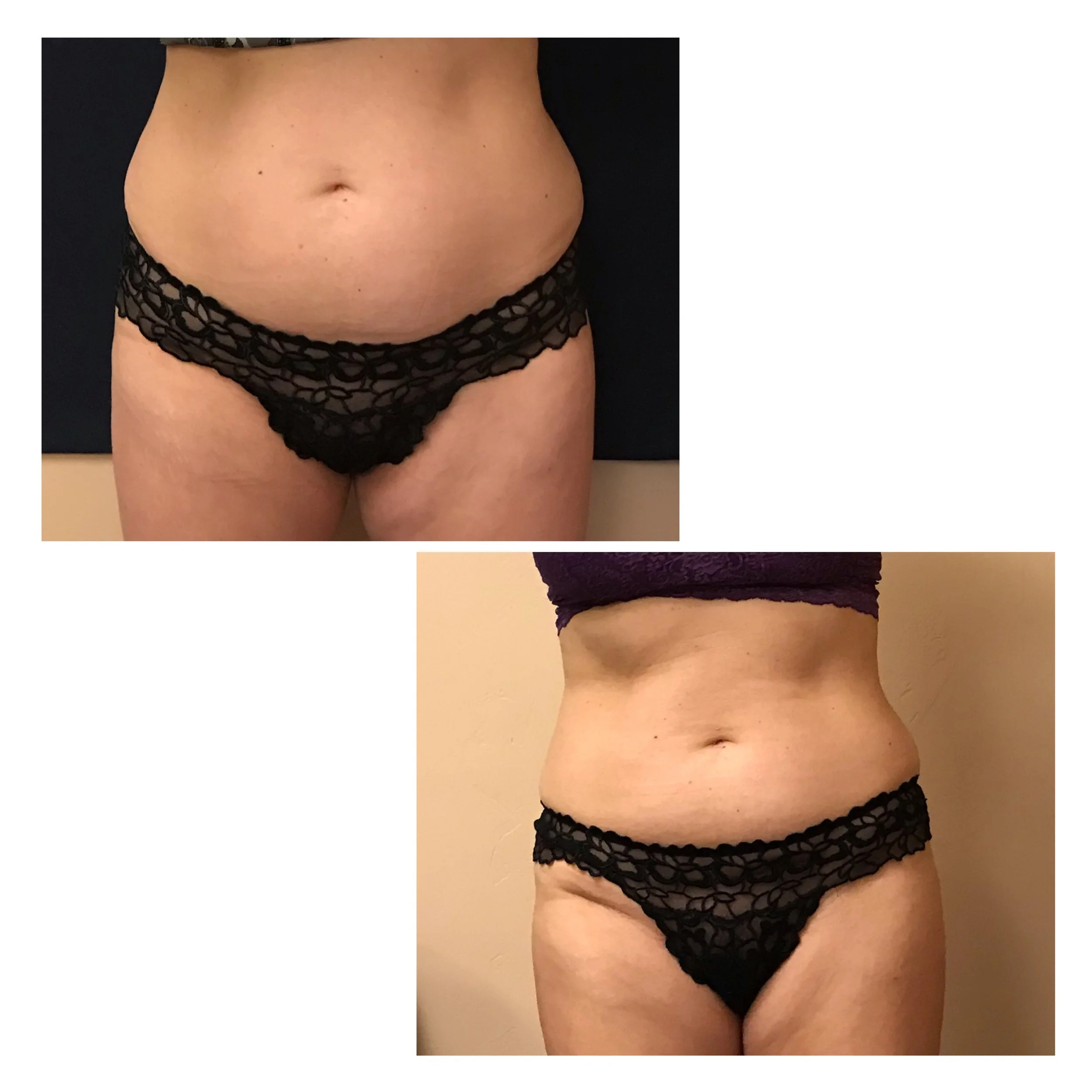 PHYSIQ BODY 6 SESSIONS