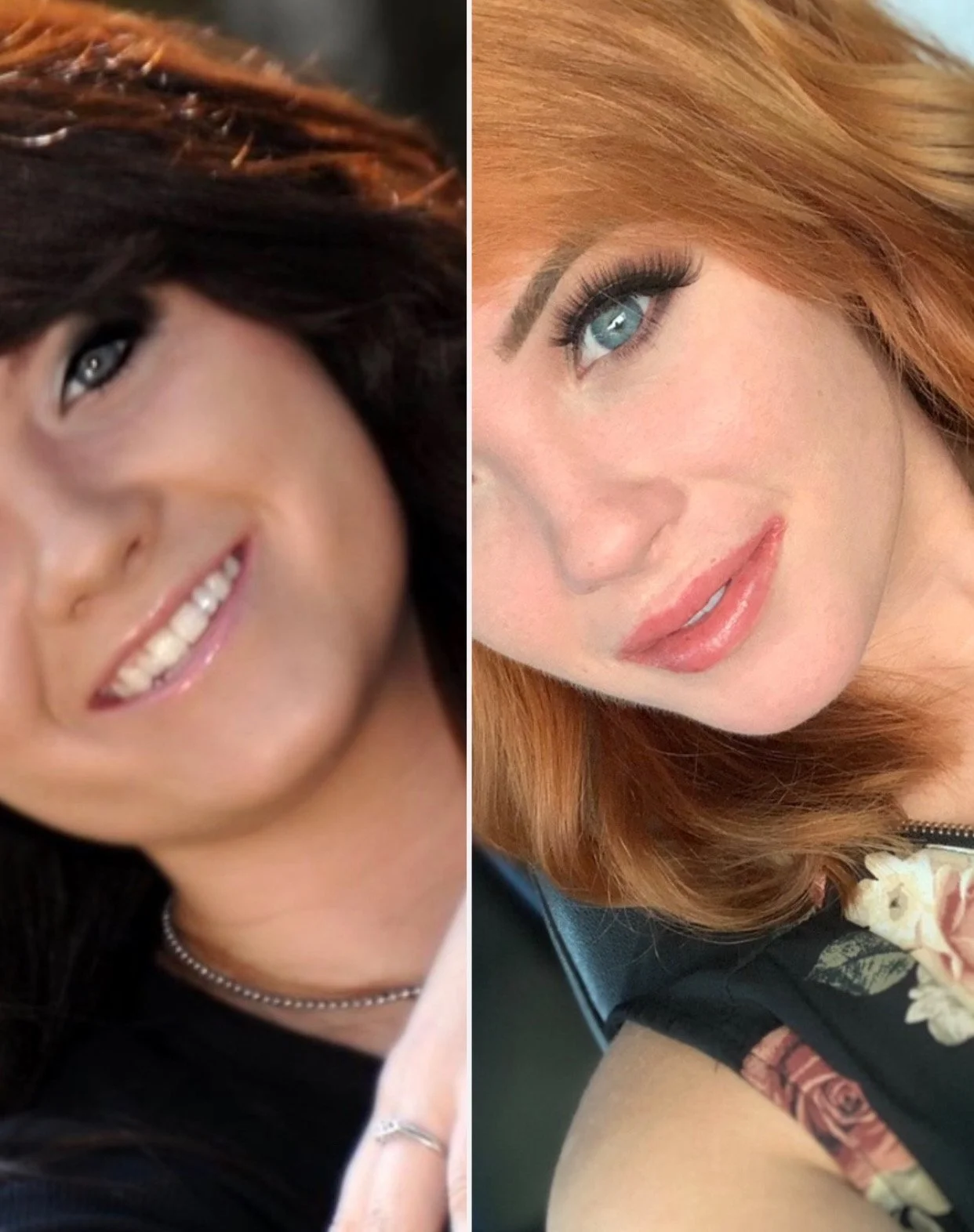 Young ladies and lips! Not too much, just enough. 