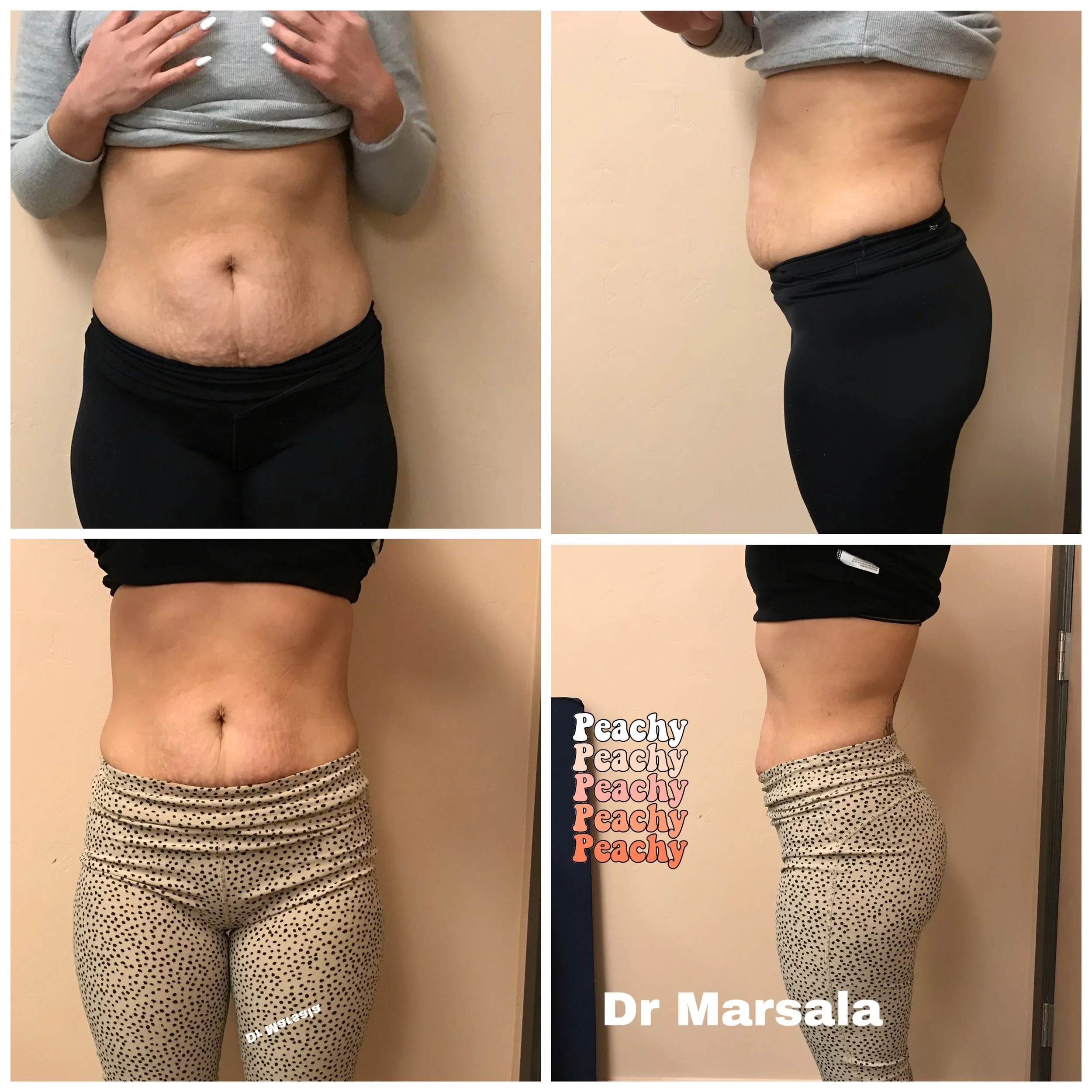 BODY SCULPTING WITH PHYSIQ 6 SESSIONS