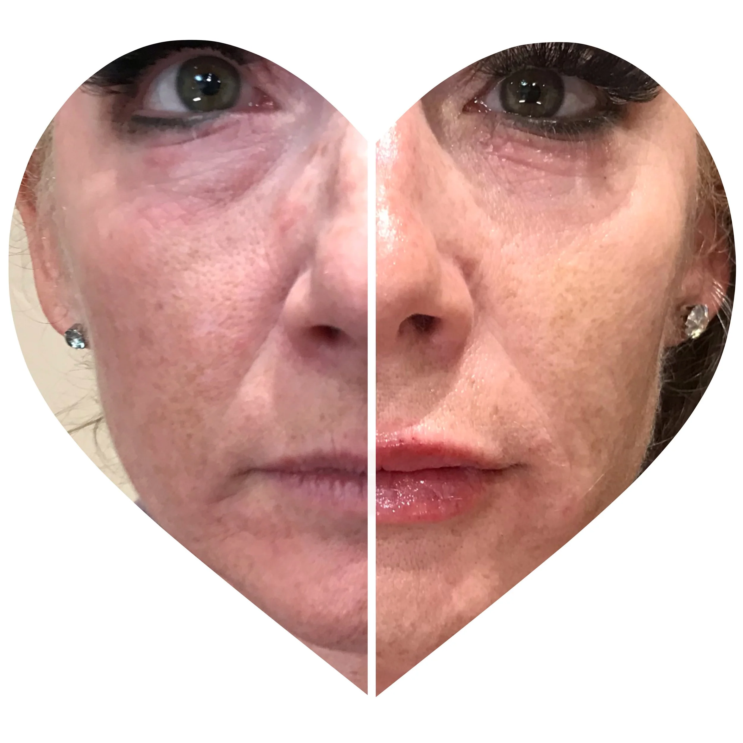 Skin care, fillers, botox