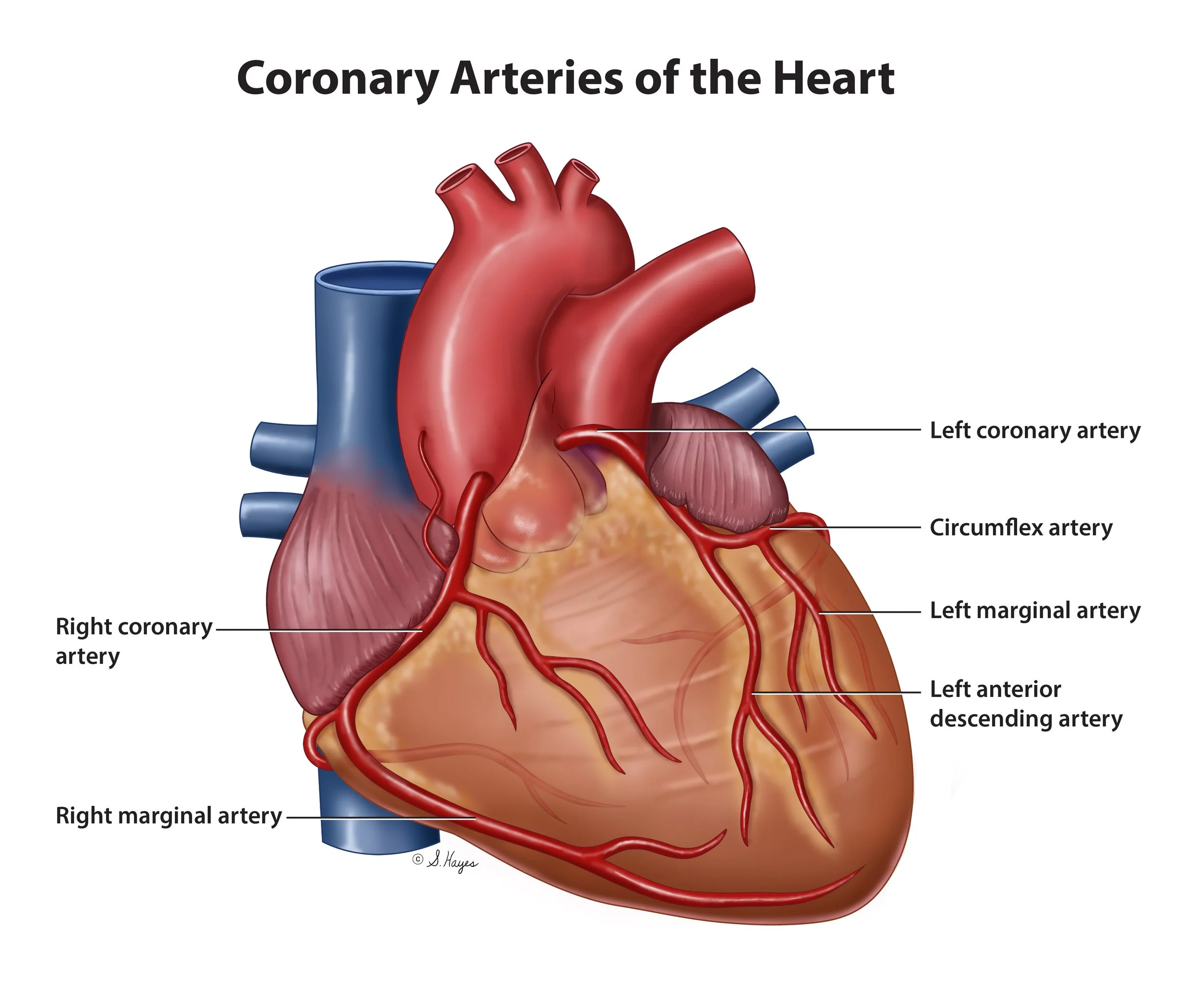 Coronary Arteries of the Heart