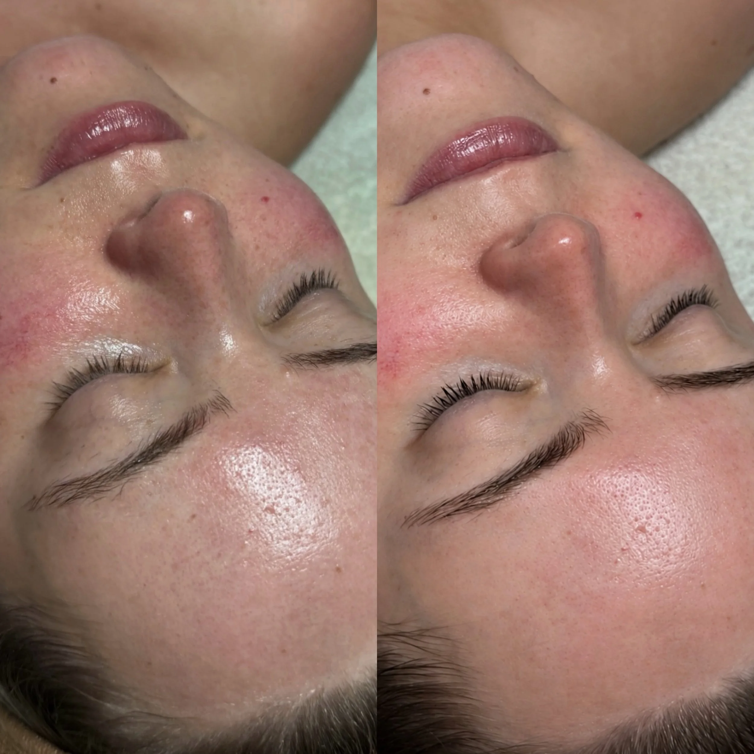 1 year of monthly facials and a customized skincare routine. Can I get an &lsquo;oww owwwwww?&rsquo; 🥰🔥