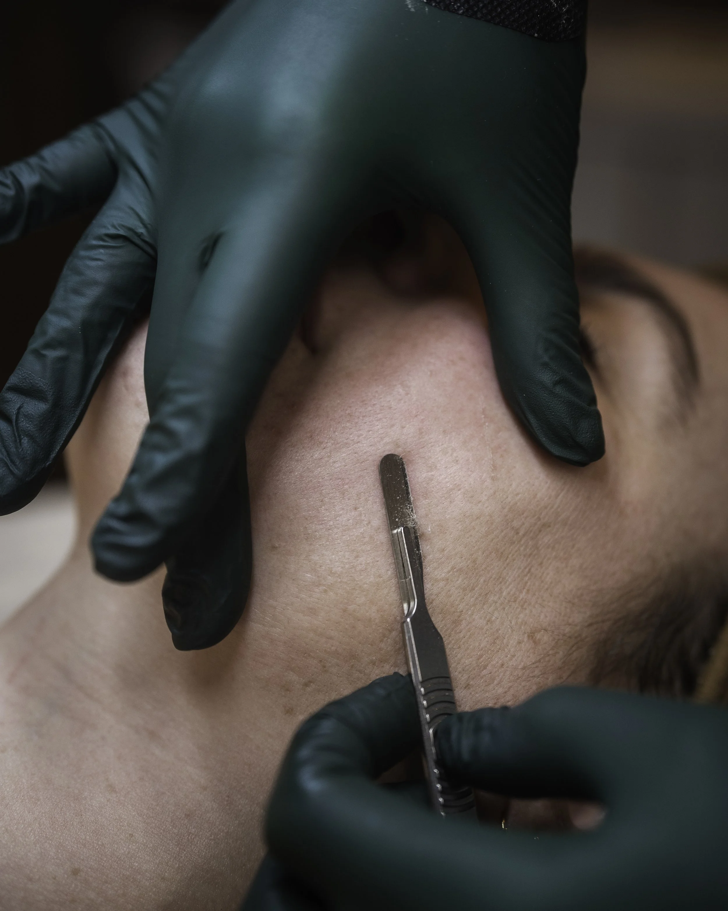 Dermaplane Express