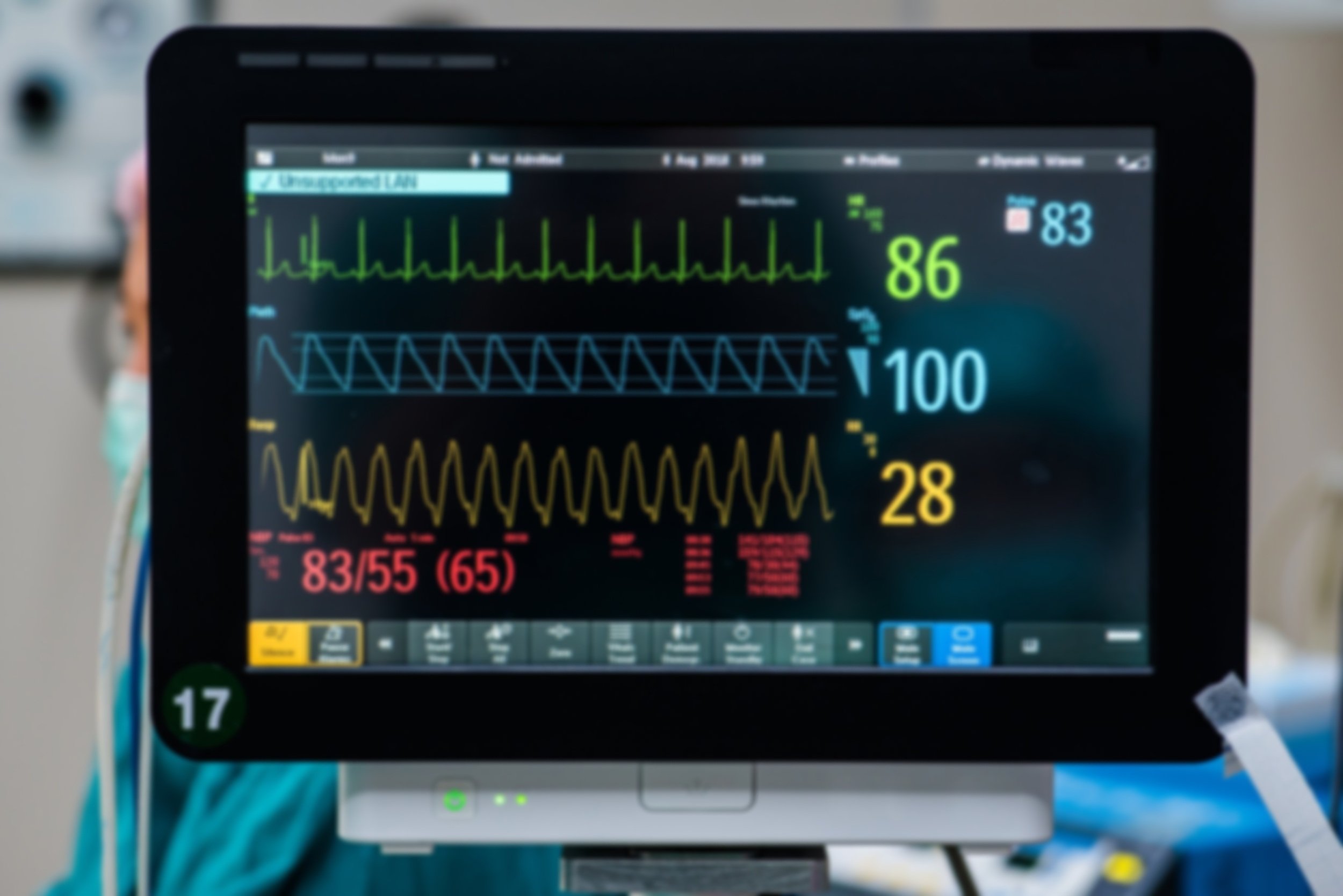 Roundtable: Patient Monitors - TechNation