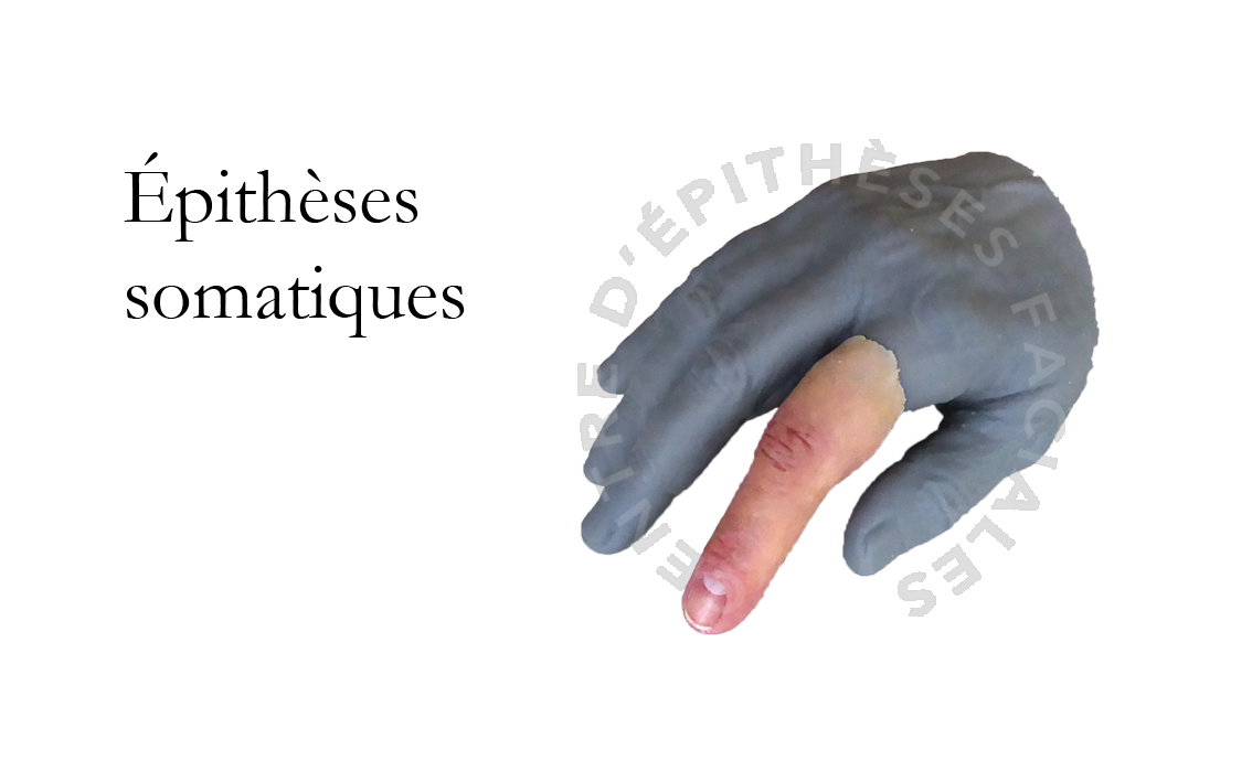 Acceuil Epithese Somatiques 2 .png