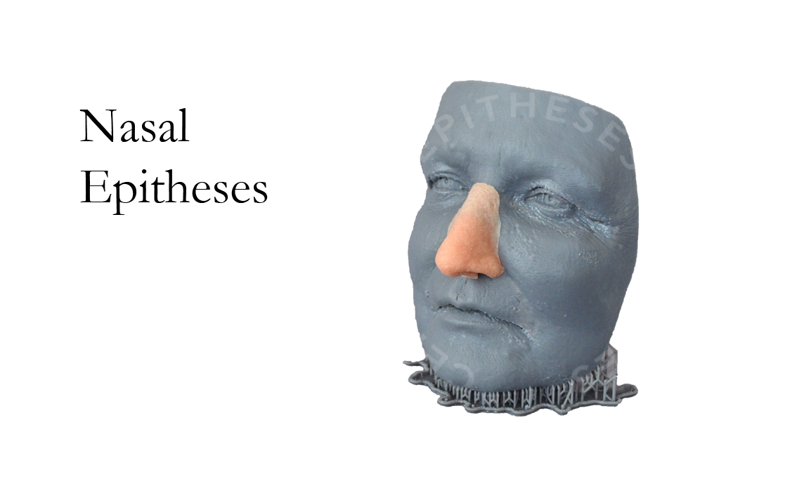 Nasal Epitheses