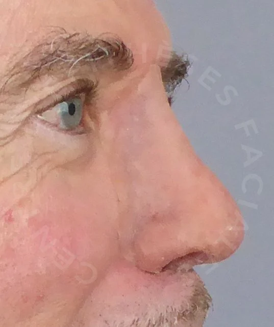 TE2.jpg