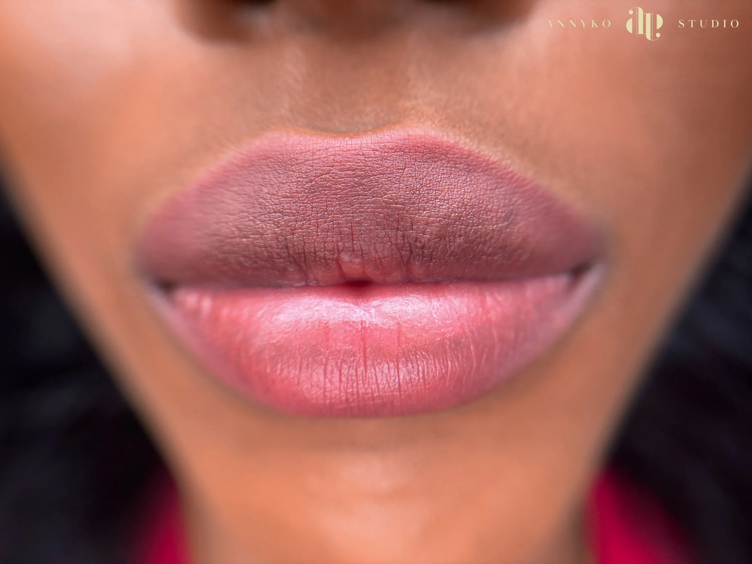 Uneven or Dark Lips? Discover Lip Neutralization