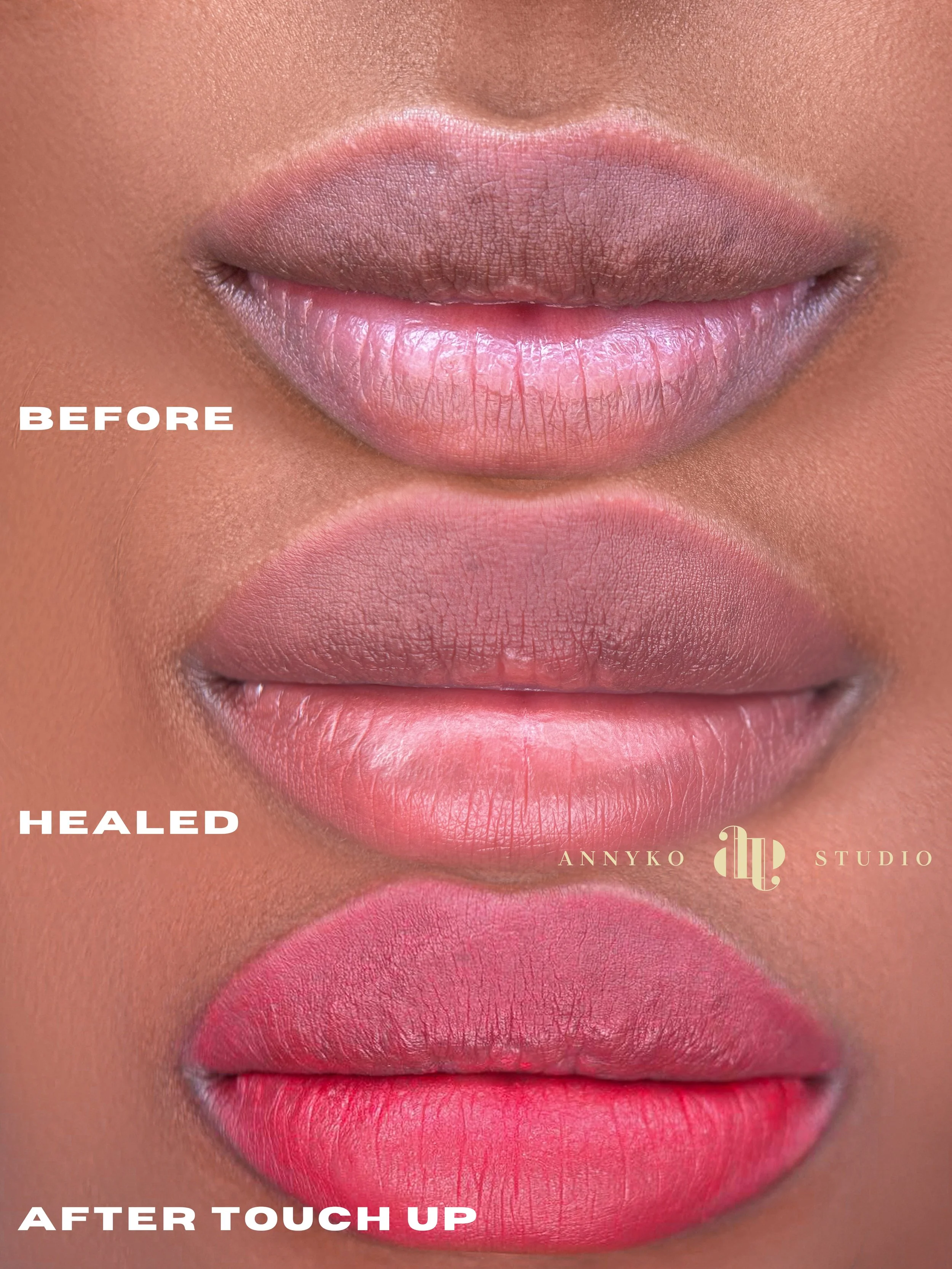 Can Dark Lip Neutralization Make Lips Pink?
