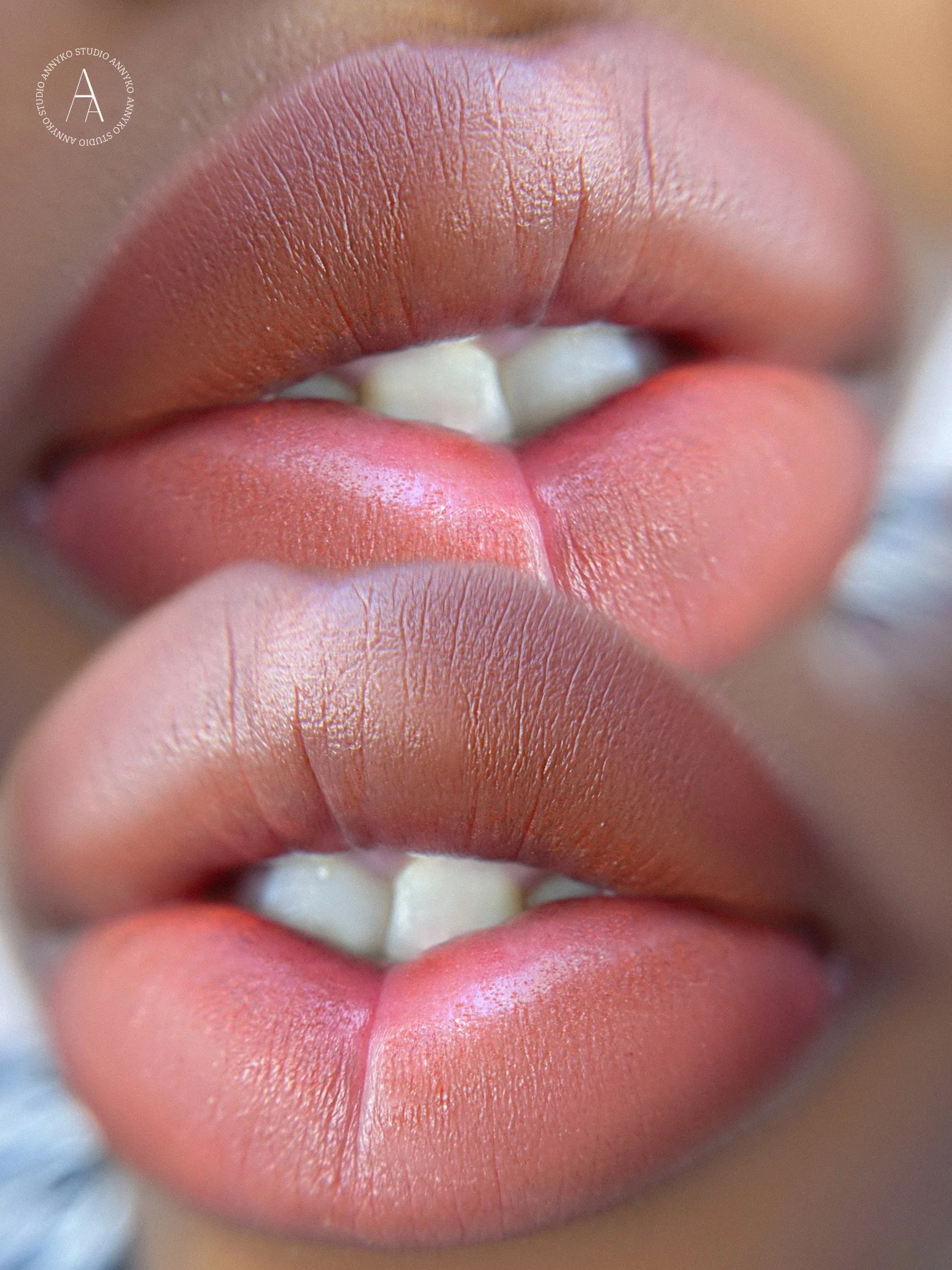 Dark Lip Neutralization —