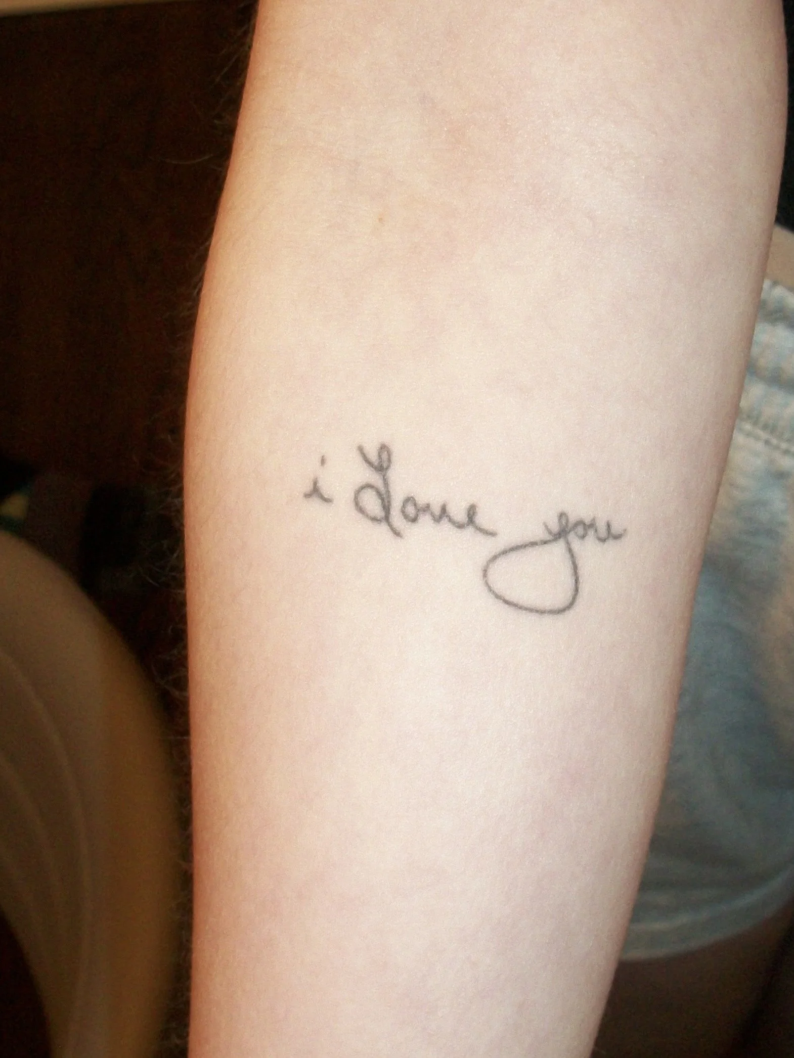 ~3 years healed