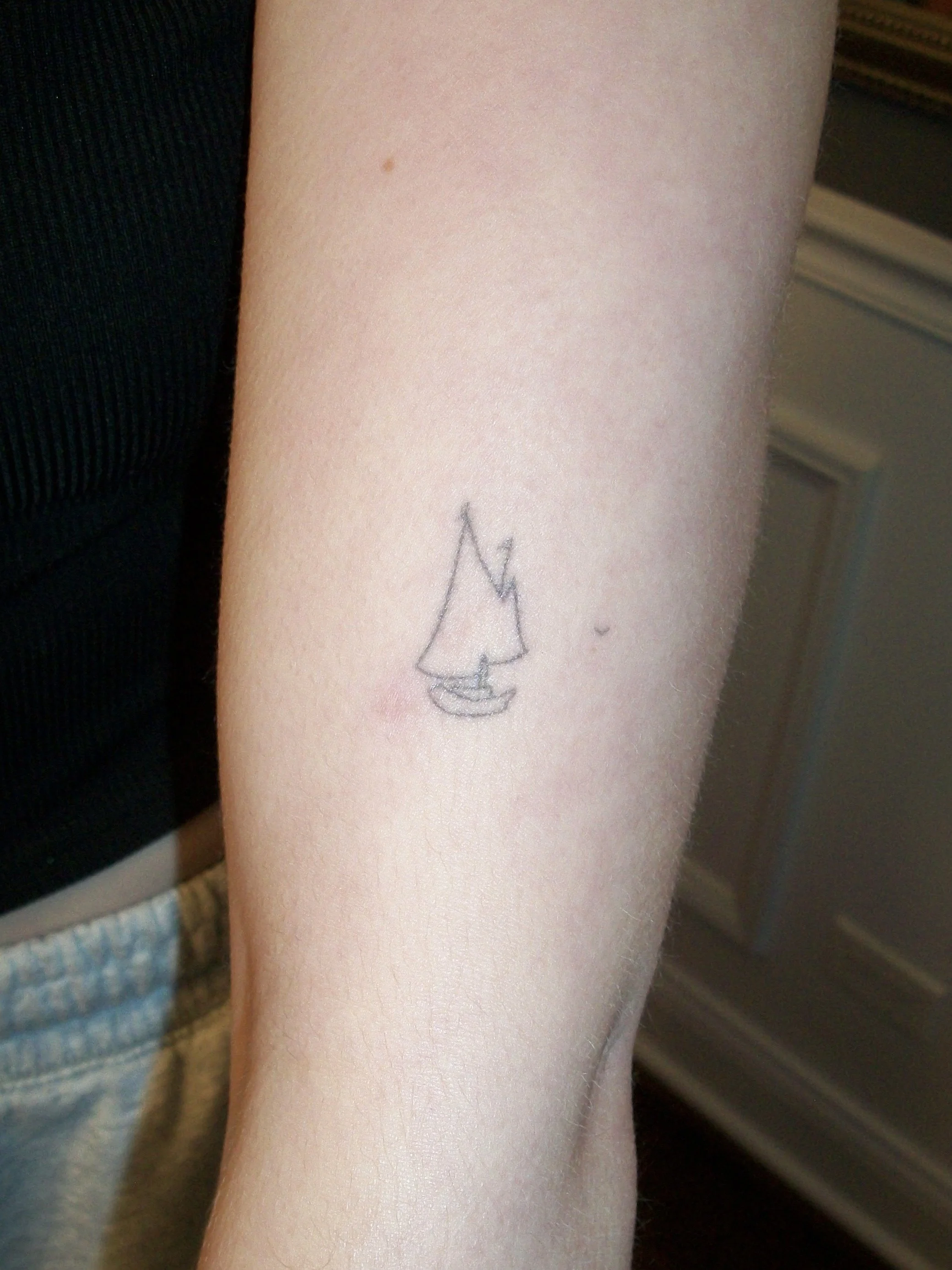 ~2.5 years healed