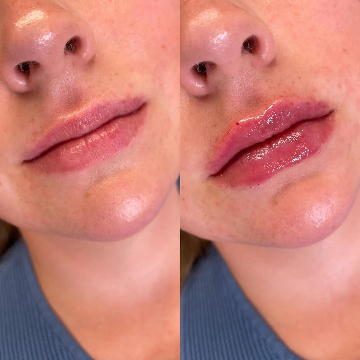 It’s givinnngggggg shape, juice and everything nice ππ₯β¨
Supportive friends who become clients are what dreams are made of
I’ve said it time and time again BUT Thank you all so much for trusting me with face π₯Ή♥οΈ
π product: 1/